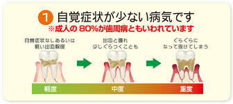 歯周病予防のセルフケア