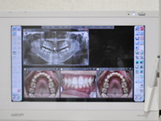 モニターなどでわかりやすく説明してくれるので、納得してから治療を進めてくれる