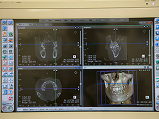 歯科用CT